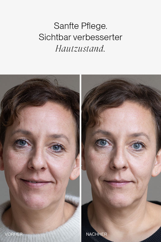 vorher-nachher Ergebnis der JACKS beauty line Skincare gegen Falten