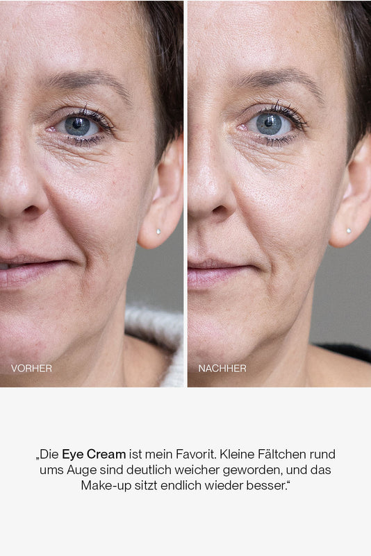 vorher-nachher Ergebnis der JACKS beauty line Augencreme