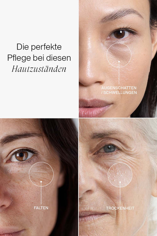 Collage von drei Hautzuständen: Augenschatten, Falten und Trockenheit