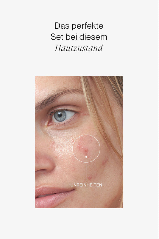 Close-up von Unreinheiten mit dem Schriftzug das perfekte Set bei diesem Hautzustand