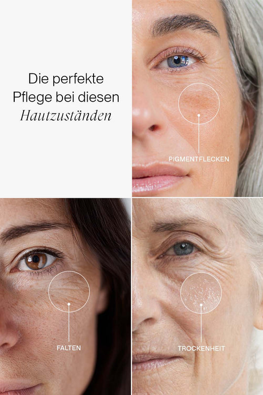 Collage von drei Hautzuständen: Pigmentflecken, Falten und Trockenheit