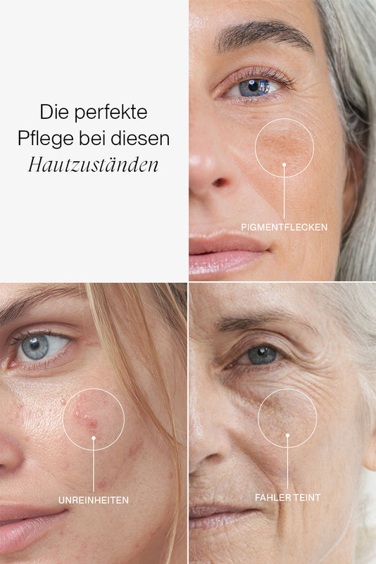 Collage von drei Hautzuständen: Pigmentflecken, Unreinheiten und Fahler Teint