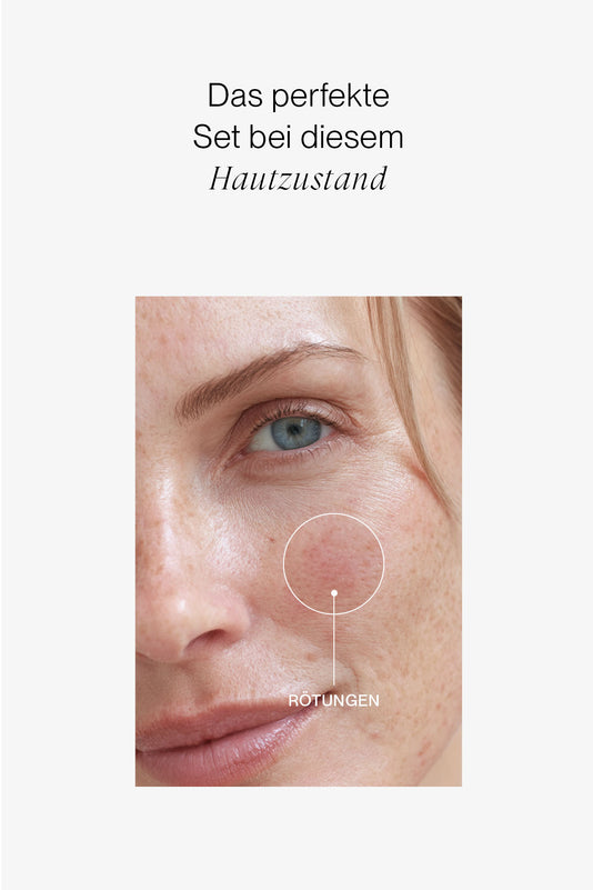 Close-up von Rötungen mit dem Schriftzug das perfekte Set bei diesem Hautzustand