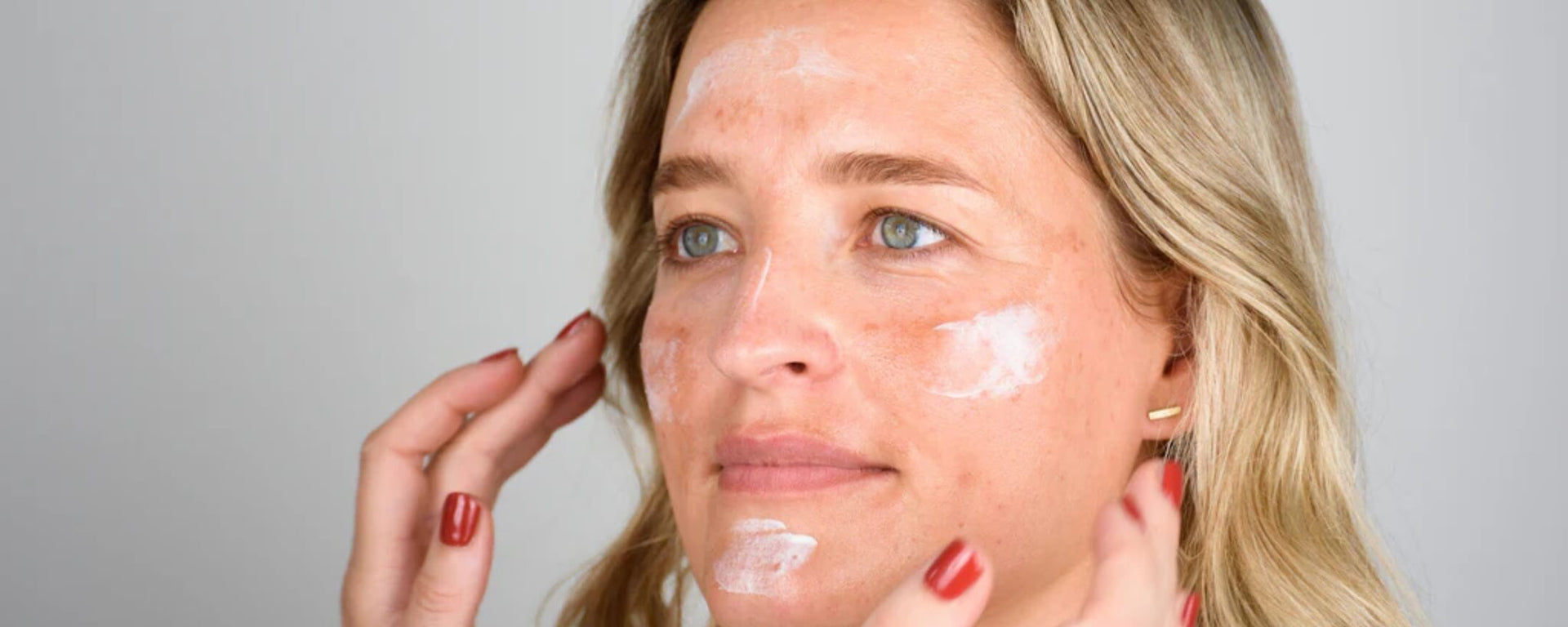 Frau mit Pigmentflecken bekommt Gesichtscreme von einer anderen Frau aufgetragen