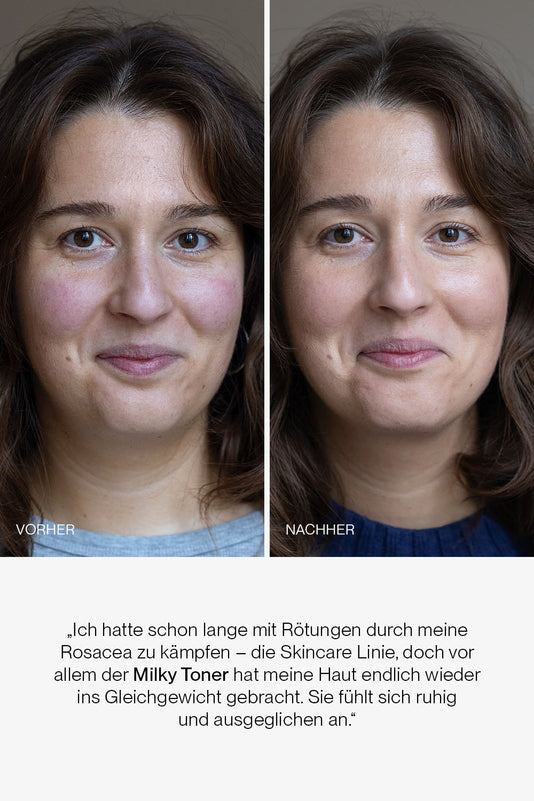 vorher-nachher Ergebnis des JACKS beauty line Milky Toners