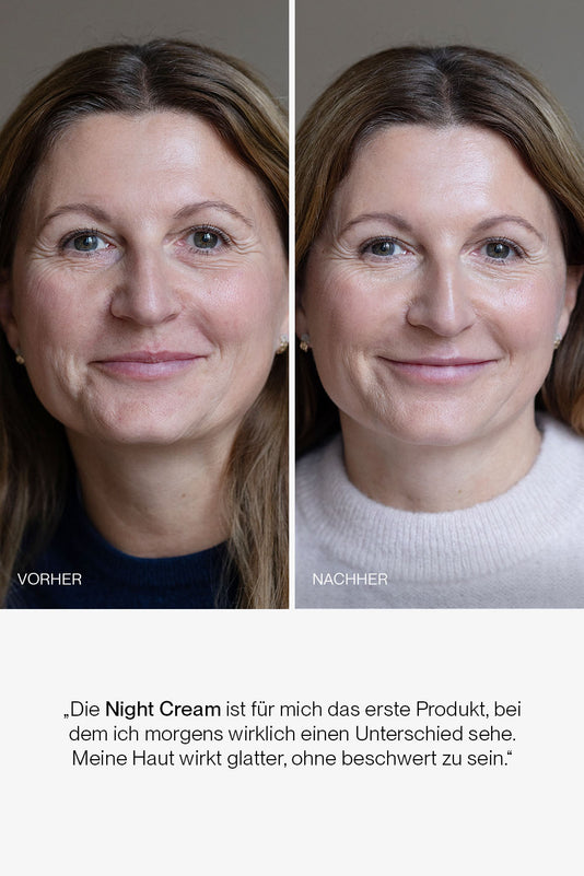 vorher-nachher Ergebnis der JACKS beauty line Night Cream
