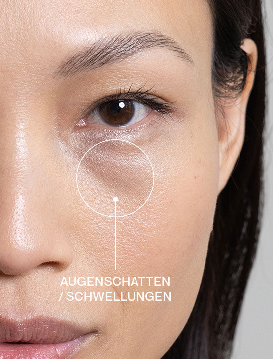 Close-up einer Frau mit Zoom auf Augenschatten und Schwellungen