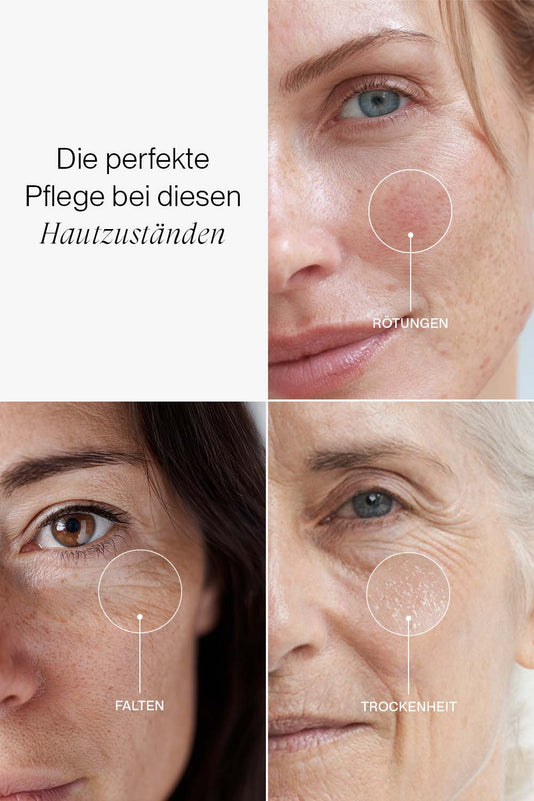Collage von drei Hautzuständen: Rötungen, Falten und Trockenheit