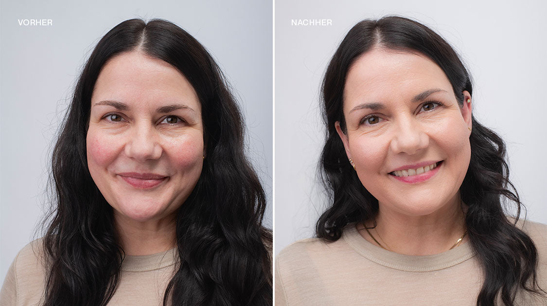 Frau mit dunklen Haaren und Rosacea im Vorher Nachher Vergleich mit und ohne Make-up